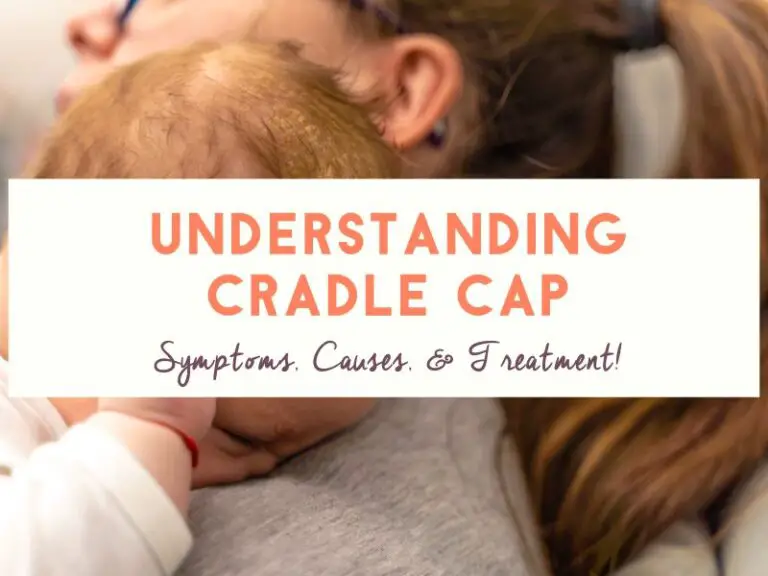 Understanding Cradle Cap Symptoms Causes And Treatment 
